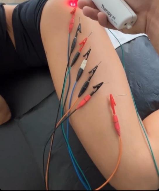 A person with wires attached to their legDescription automatically generated